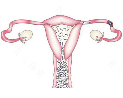 输卵管通水后感染是会堵塞吗 输卵管通水后感染是会堵塞吗