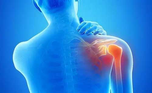 肩关节扭伤怎么办恢复快 肩关节扭伤怎么办恢复快