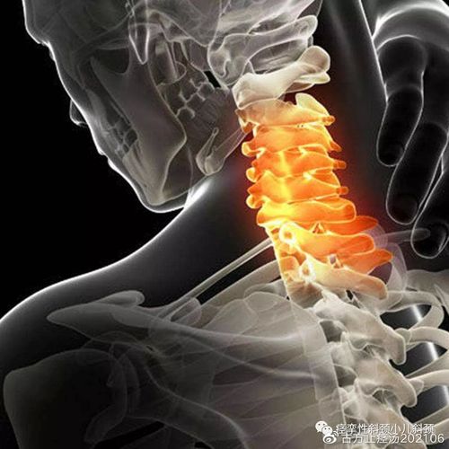 寝室的人都产生了耳鸣是什么原因 寝室的人都产生了耳鸣是什么原因