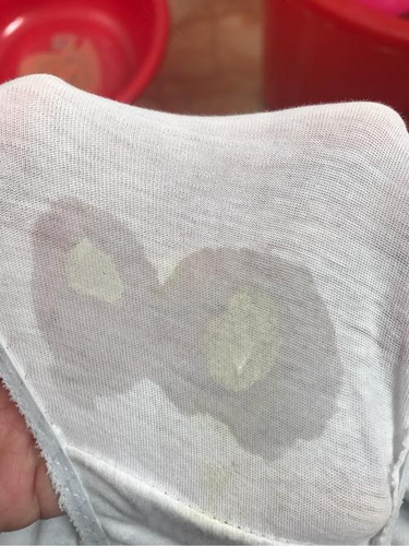 白带是乳白色不透明是怎么了 白带是乳白色不透明是怎么了