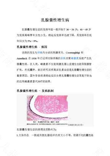 囊性乳腺增生症状表现 囊性乳腺增生症状表现