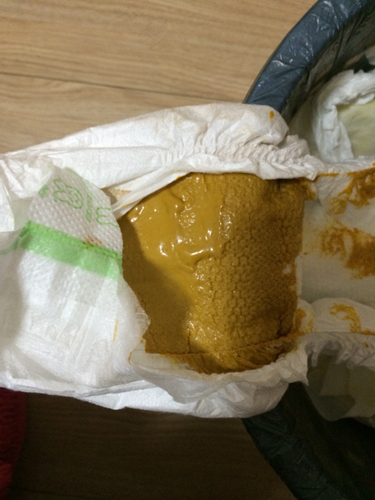 10几天没有大便了怎么办 10几天没有大便了怎么办