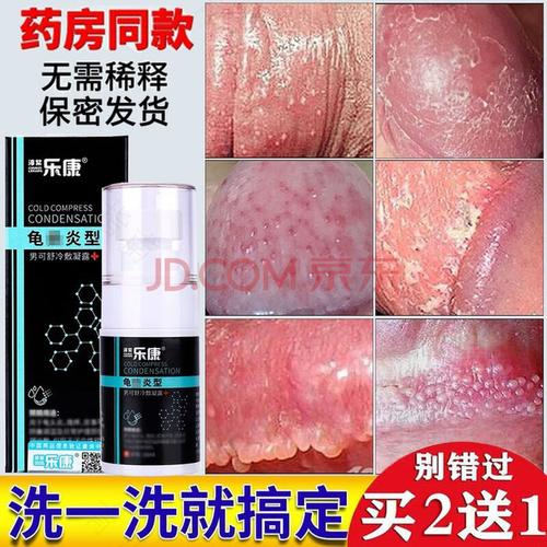 男性阴囊痒痒的是什么原因 男性阴囊痒痒的是什么原因