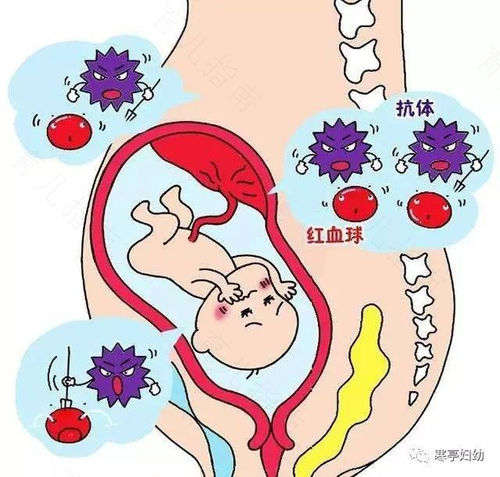 什么是溶血病很严重吗 什么是溶血病很严重吗
