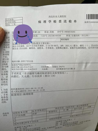 子宫内膜炎是什么引起的 子宫内膜炎是什么引起的