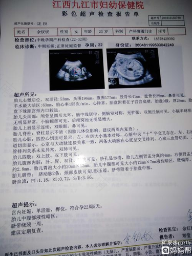 乳腺不规则液性暗区严重吗 乳腺不规则液性暗区严重吗