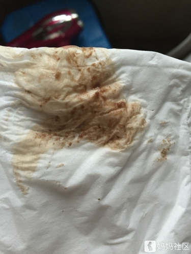 白带有点带红色是怎么回事