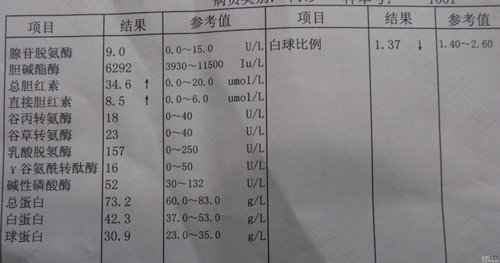 tbil总胆红素偏高怎么办 tbil总胆红素偏高怎么办