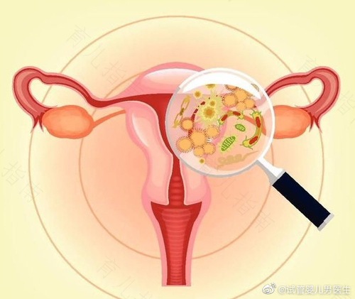 左侧输卵管阵痛是什么原因 左侧输卵管阵痛是什么原因