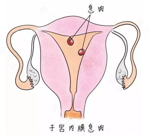 怎样判断子宫左旋还是右旋 怎样判断子宫左旋还是右旋