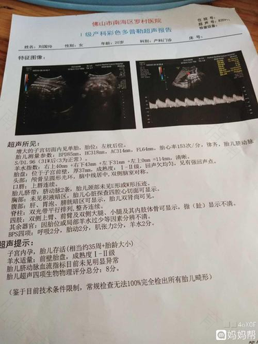 28周胎盘钙化怎么办