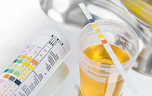 尿蛋白高能不能吃鸡蛋牛奶 尿蛋白高能不能吃鸡蛋牛奶