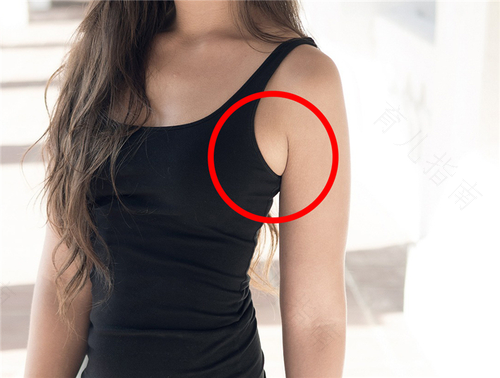 真性副乳可以不管它吗 真性副乳可以不管它吗