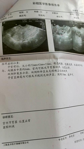 宫颈囊肿同房会出血吗