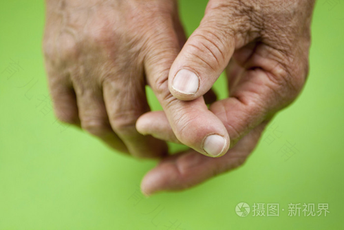 类风湿手关节肿胀疼痛怎么办