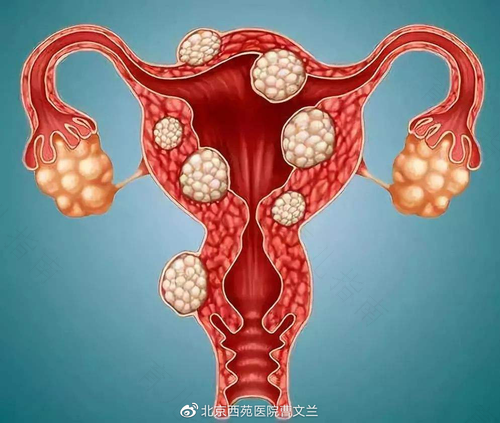 绝经后身体会出现什么症状 绝经后身体会出现什么症状