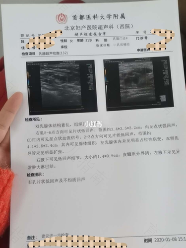 非哺乳期乳腺炎脓肿切开恢复要多久 非哺乳期乳腺炎脓肿切开恢复要多久