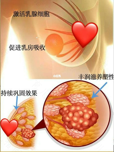 乳腺肿块是什么原因造成的? 乳腺肿块是什么原因造成的?