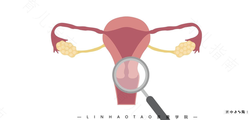 绝经后出血是什么原因导致的 绝经后出血是什么原因导致的