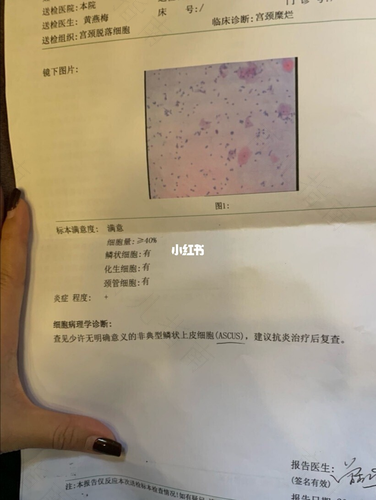 hpv感染自己会好吗 hpv感染自己会好吗