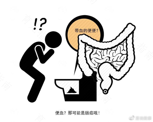 小腹隐痛屁多是肠癌吗 小腹隐痛屁多是肠癌吗