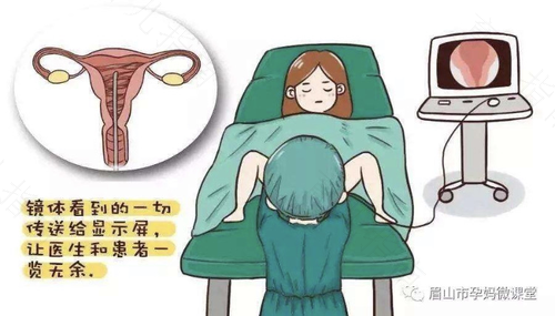 宫腔镜检查哪些疾病 宫腔镜检查哪些疾病