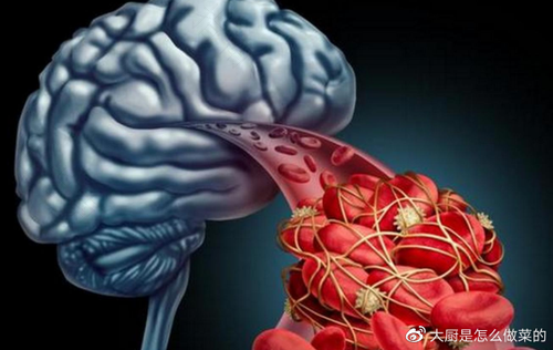 经常大脑供血不足怎么办 经常大脑供血不足怎么办