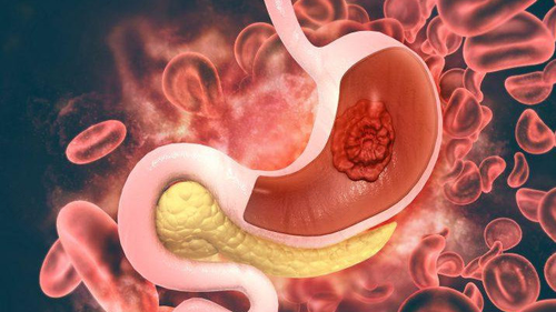 胃病怎么养好得快 胃病怎么养好得快