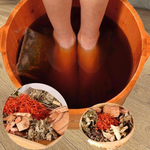 艾草水泡脚治痛风吗 艾草水泡脚治痛风吗