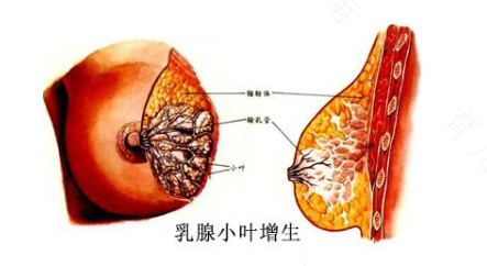 乳腺增生能用手揉吗 乳腺增生能用手揉吗