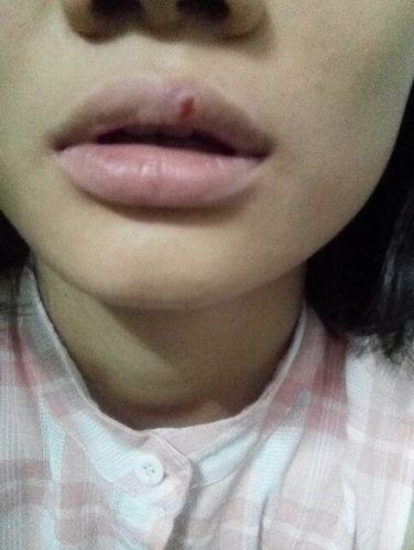 婴儿下嘴唇抽搐怎么回事 婴儿下嘴唇抽搐怎么回事