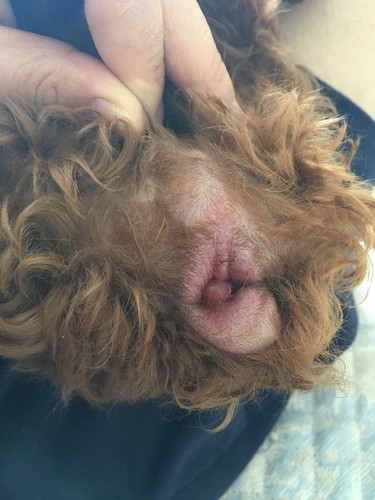 肛门上火红肿怎么办 肛门上火红肿怎么办