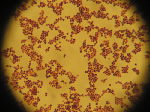 龟头有真菌感染怎么办 龟头有真菌感染怎么办