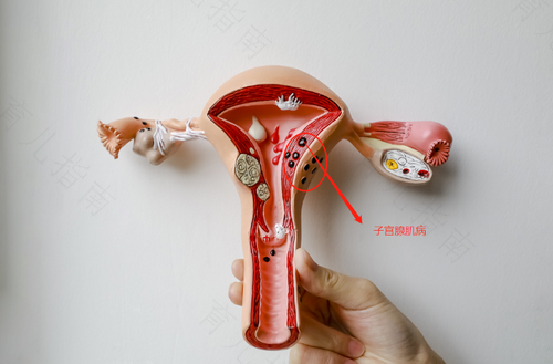 子宫小怎样治疗吃什么药 子宫小怎样治疗吃什么药