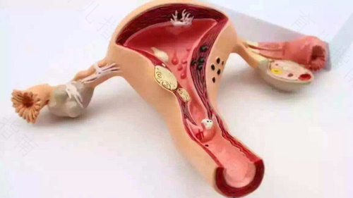 女人子宫炎怎么引起的