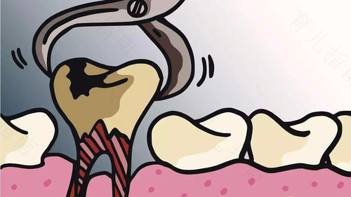 一般拔牙需要多长时间? 一般拔牙需要多长时间?