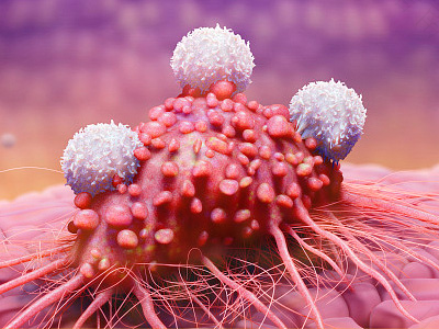 什么是尖锐湿尤症状