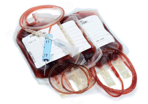 轻度的糖尿病可以献血吗 轻度的糖尿病可以献血吗