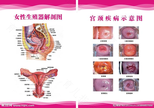 宫颈息肉病理检查多久出结果