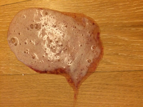 恶心想吐反胃是怎么回事