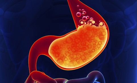 病毒性肠胃炎的症状及治疗 病毒性肠胃炎的症状及治疗