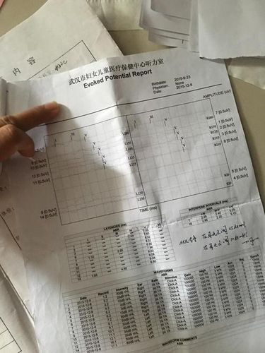 听力初筛一侧未通过