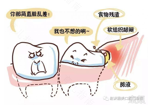 刚拔完智齿可以吃水果吗 刚拔完智齿可以吃水果吗