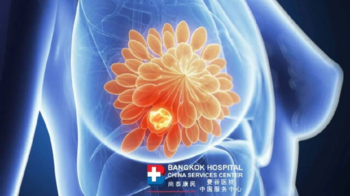 乳房有囊性包块怎么办 乳房有囊性包块怎么办