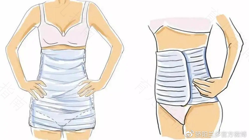 子宫切除术后多久可以不用戴腹带