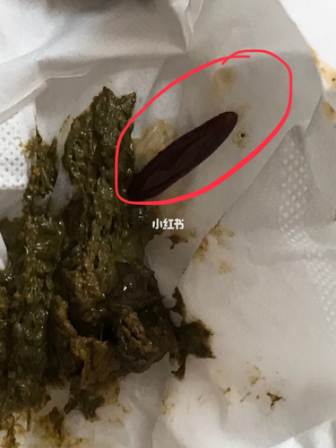 孩子腹胀拉不出大便怎么办