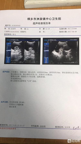 宫颈管分离是怎么回事 宫颈管分离是怎么回事