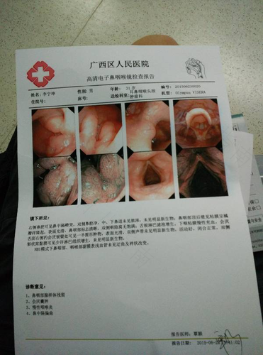 慢性咽喉炎会不会传染给小孩? 慢性咽喉炎会不会传染给小孩?