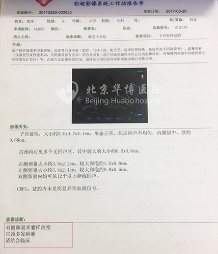 怎么能检查出多囊卵巢 怎么能检查出多囊卵巢