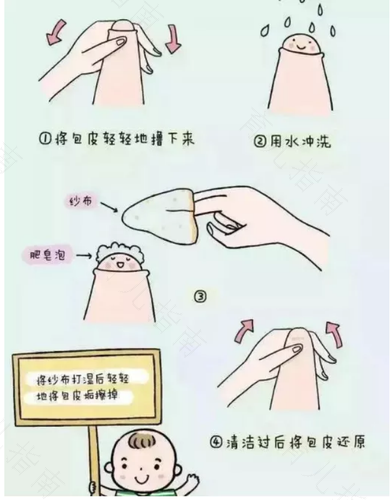 龟头垢洗不掉怎么办 龟头垢洗不掉怎么办